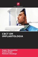 Sagar Narayankar (U. A.) | Cbct EM Implantologia | Taschenbuch | Portugiesisch