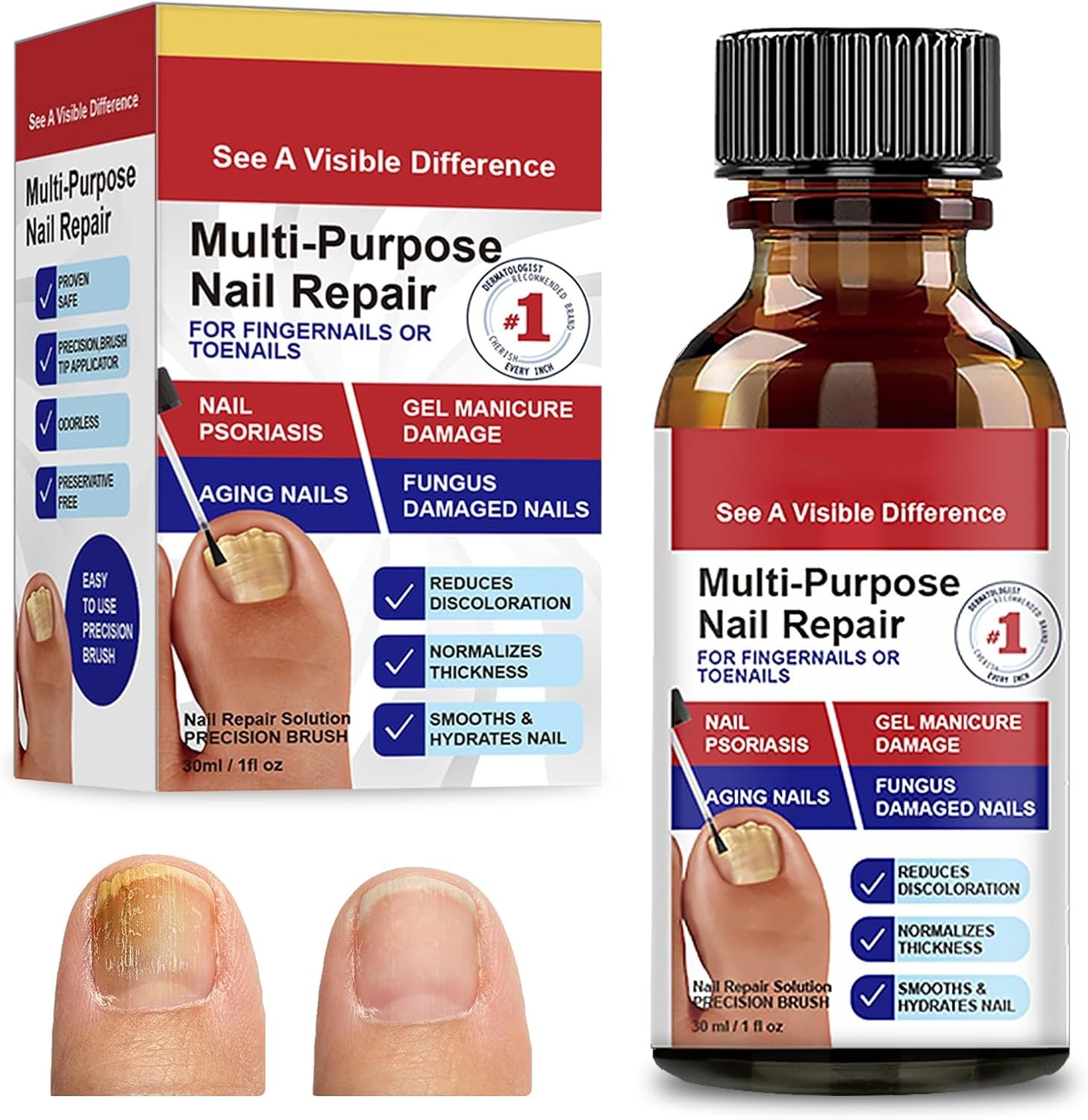 30ml Nail Treatment, Nail Recovery Serum, Toenail Strengthener, Effectively Imp