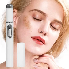 1pc Skin Care Pen Non - Invasive Mole and Wart Removal Laser Pen NEW