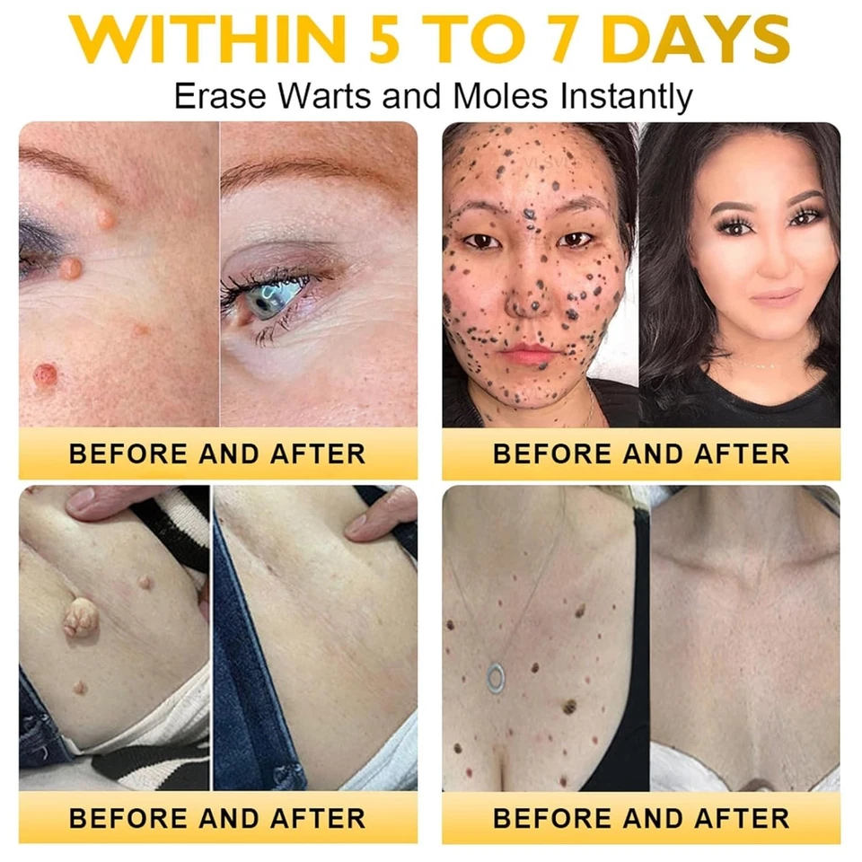 Bee Venom Skin Restoration Cream Professional Bee Venom Skin Cream Deeply Clean - Bild 2 von 4