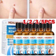 Wart Remover Liquid Skin Tag Mole Remover Eliminate Foot Corn Warts Unisex 30ML