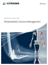 Periprosthetic Fracture Management | Michael ...