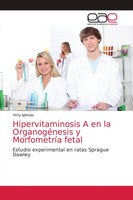 Hipervitaminosis A En La OrganogéNesis Y MorfometríA Fetal Yeny Iglesias Buch
