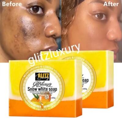 X 1 soap glitzluxury Snow white turmeric-honey, kojic whitening & acne treatment