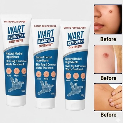 3pcs 7 Days Genital Wart Removal Cream for Men & Women 100g/3.4oz Free shipping