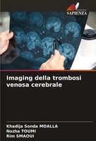 Khadija Sonda Moalla (U. A.) | Imaging Della Trombosi Venosa Cerebrale | Buch