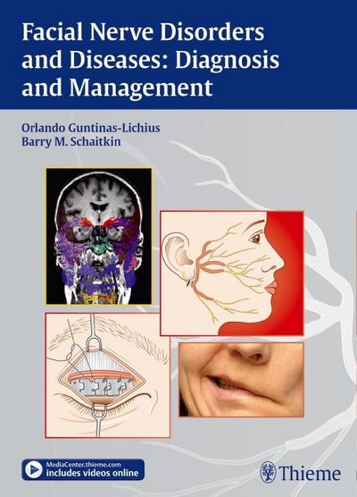 Facial Nerve Disorders And Diseases: Diagnosis And Management: Includes Vid-image
