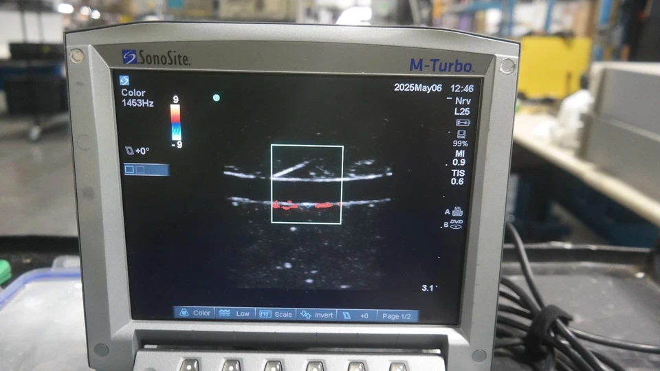Sistema de Ultrassom Portátil SonoSite M-Turbo Ref P08189-80 + Garantia - Imagem 4 de 4