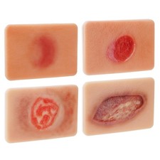 Pressure Ulcer Wound Model Stages I–IV: Silicone Decubitus Care Training Kit US