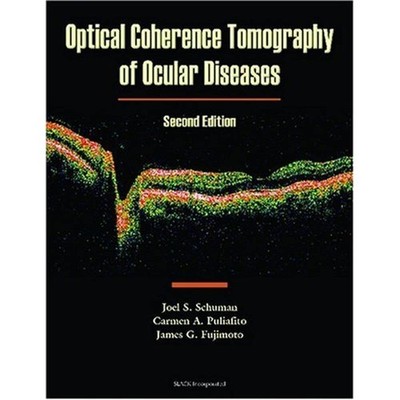 Optical Coherence Tomography of Ocular Diseases