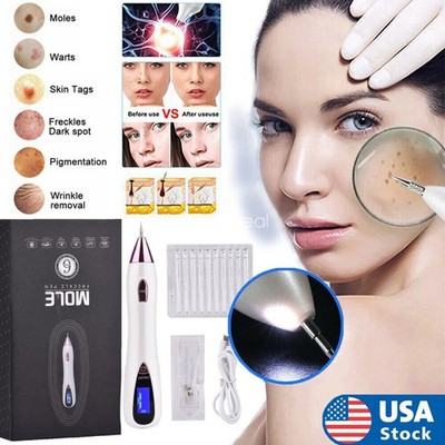 Laser Plasma Pen Skin Tag Freckle Removal Dark Spot Tattoo Wart Remover Pen -USA