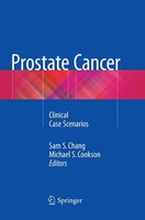 Sam S. Chang (U. A.) | Prostate Cancer | Taschenbuch | Englisch (2019) | Xiii