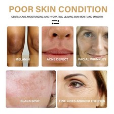 EELHOE Turmeric Dark Spot Correcting Serum Face Care Spot Moisturizing Nourishin