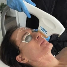 IPL 190nm-11000nm Beauty Protection Eye Patch + Safety Eye Shield