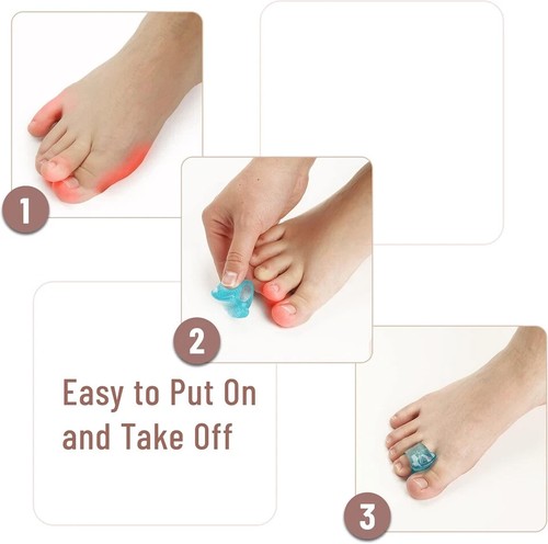 Dr. JK- Gel Toe Separators for Overlapping Toes, 6 Pack, Toe Separators for Wome - Picture 4 of 8
