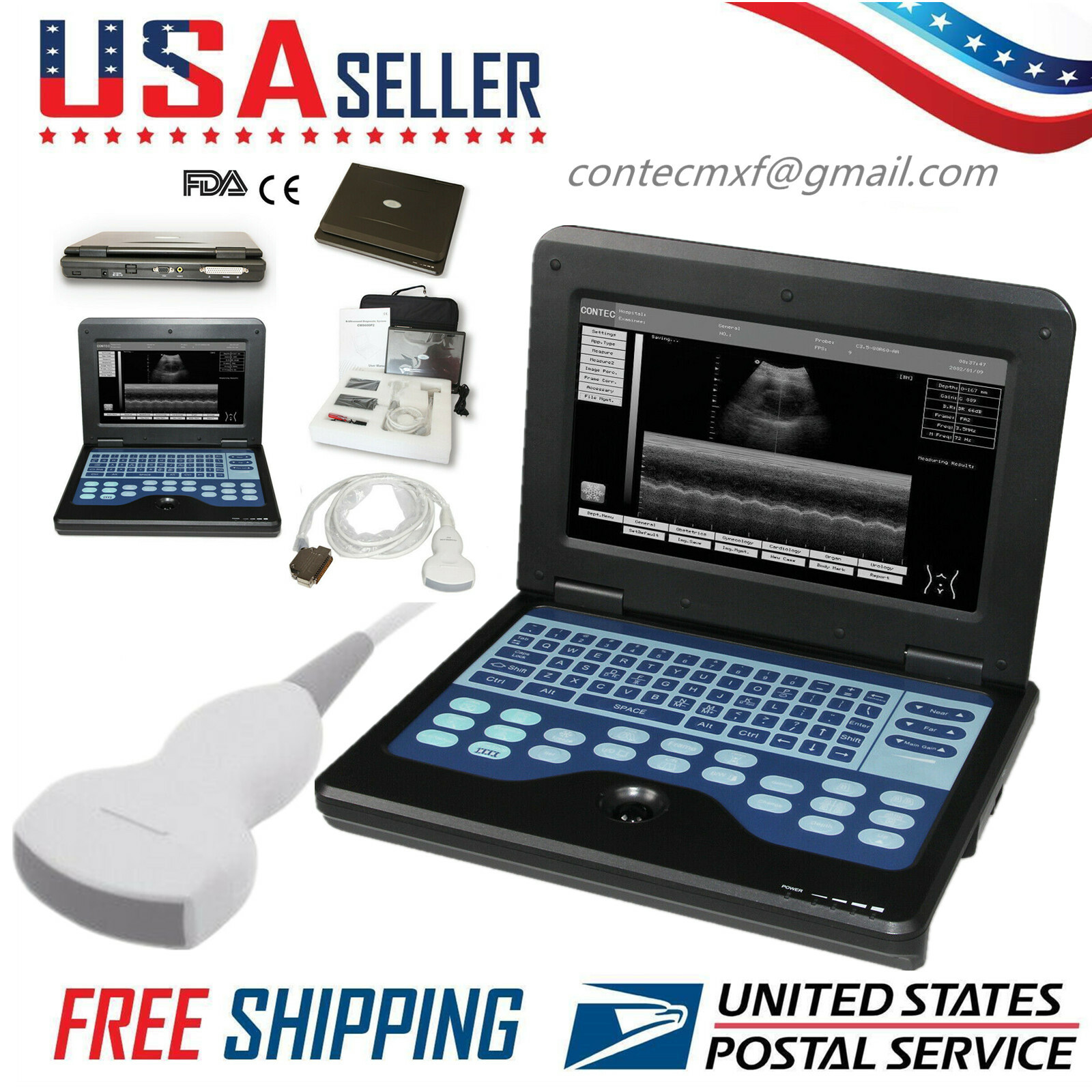 FDA CMS600P2 Portable Ultrasound Scanner Laptop Machine with 3.5Mhz Convex Probe