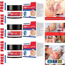 3 x Herbal Anti Itch Cream for Eczema Fungal Relief 30g FREE SHIPPING