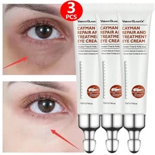 3X Under Eye Cream Gel Remove Dark Circles Crows Feet Bags Lift Firm Anti Aging