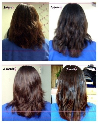So Fast Long Hair Fast Growth Shampoo Helps Your Hair To Lengthen