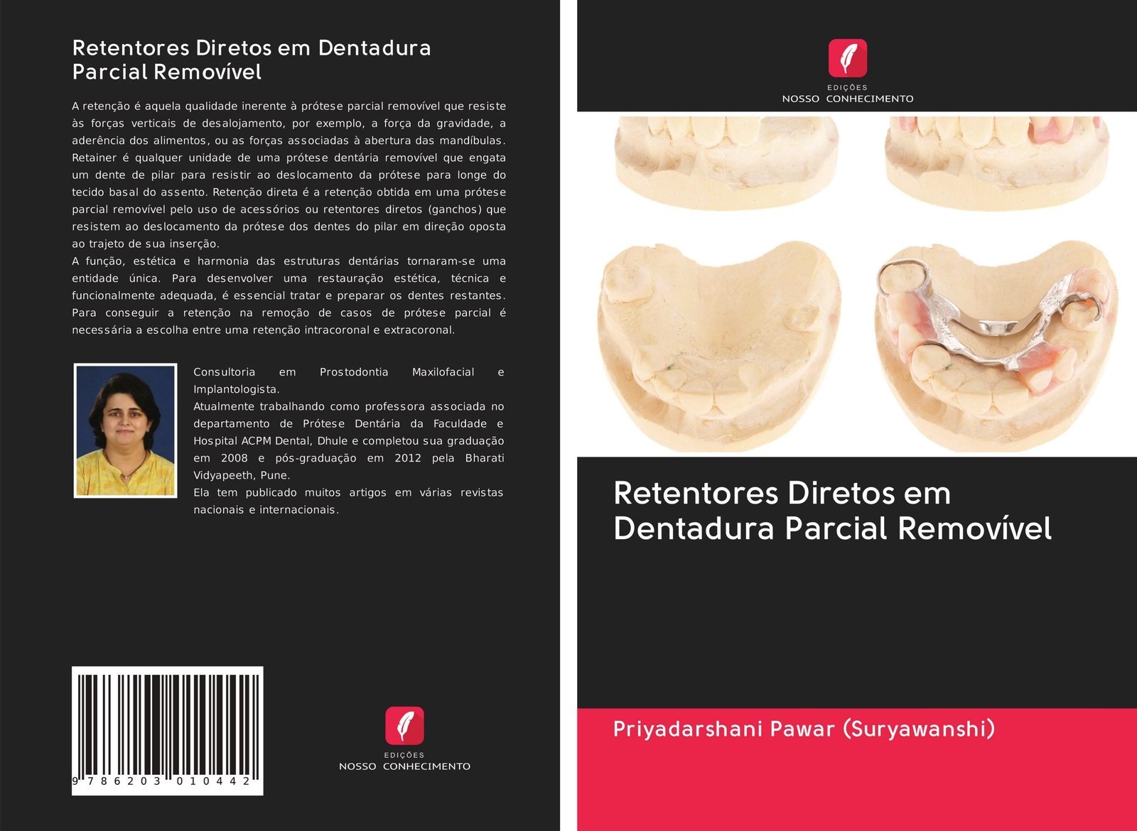 Thumbnail - Retentores Diretos Em Dentadura Parcial Removível Priyadarshani Pawar