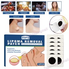 12 Sheet Lipoma Removal Patch Herbal Organic Lipolysis Fat Lump Relief Patch