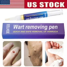 12 Hours Wart Remover Pen Eliminate Skin Tag Foot Corn Mole Warts Restoration US