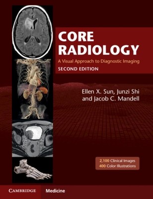 CORE RADIOLOGY (Taschenbuch) (9781108965910)