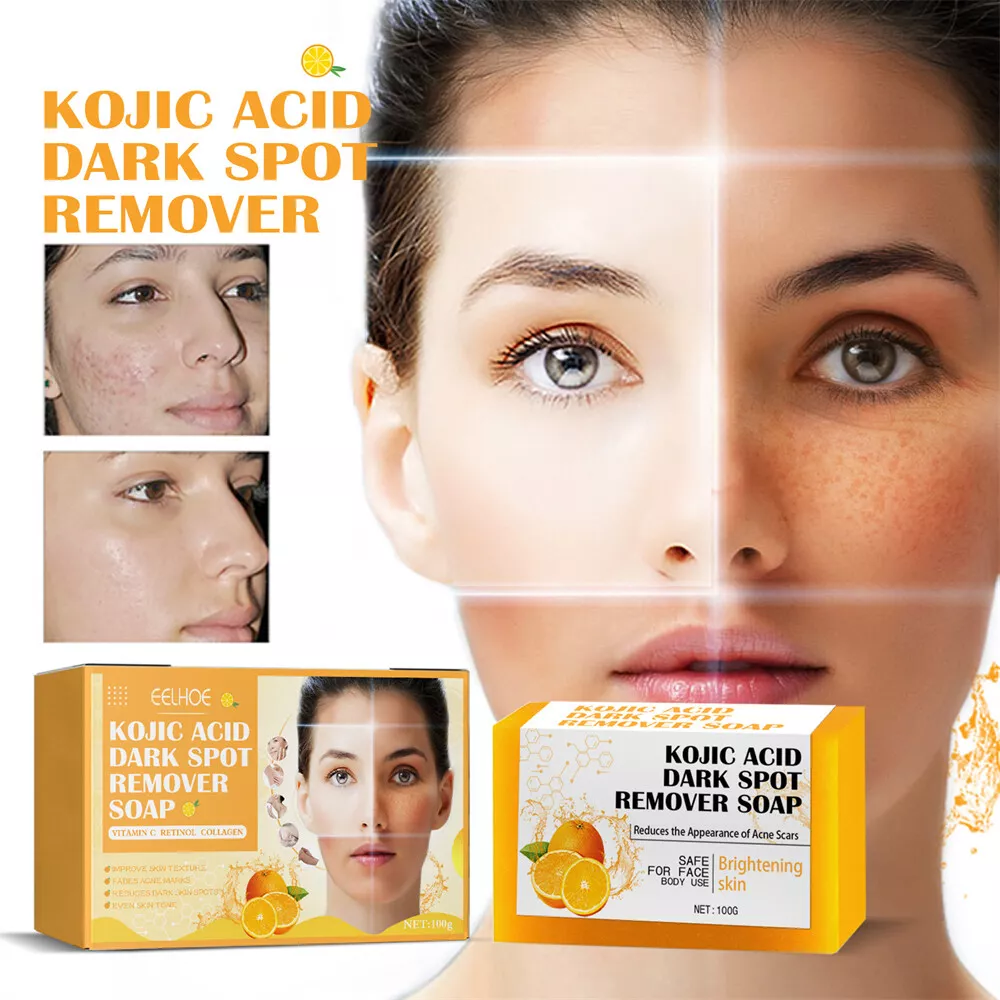 Soap for cheap acne scars