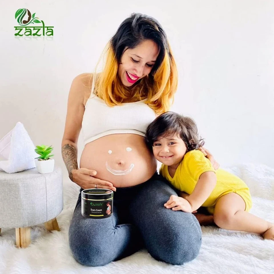 Best Scar Removal-Cream for Old-Scars Stretch Mark Removal Cream UNISEX 100gm - Image 4 of 4