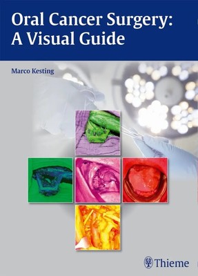 Oral Cancer Surgery | A Visual Guide | Marco Kesting | Englisch | Buch | 132 S.