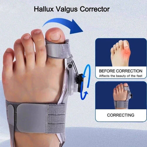 Bunion Valgus Corrector Bunion Splint Mit Adjust Degrees Silikon Hallux Valgus - Bild 7 von 38