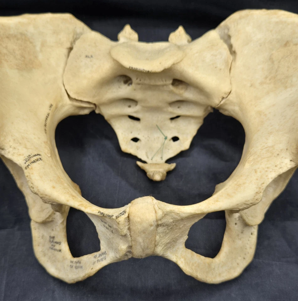 Pelvis adulta hembra con demostrador de paciente L4 y L5 de Sawbones completamente etiquetado Foto 2 de 4