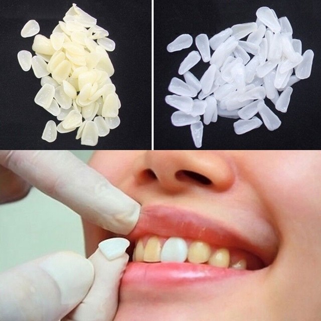 100Pc White Dental UltraThin Whitening Veneers Resin Teeth Upper