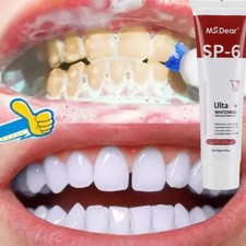 Sp-6 Probiotic Whitening Toothpaste Brightening Bad Breath Removing Toothpaste