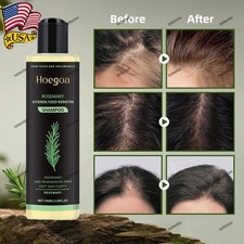 Organic Rosemary Hair Growth Shampoo for Women and Men-Natural Thickening 8 Stre