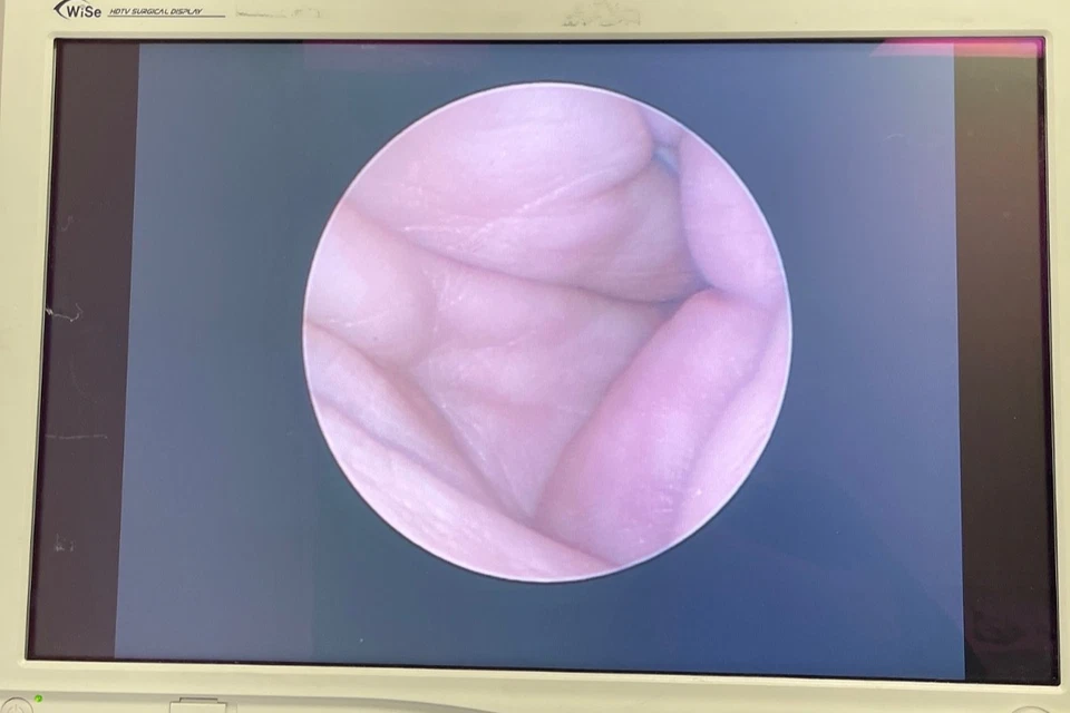 ACMI G27L12A 2,7 mm x 12 ° x 31 cm histeroscopio autoclavable Storz poste de luz ginecólogo Foto 2 de 4