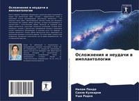 Oslozhneniq I Neudachi W Implantologii Nilam Pande