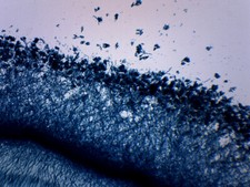 25PK Fungi Molds, 3 Types - WM - Prepared Slides - 75x25mm - Eisco Labs