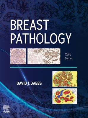 Breast Pathology, Dabbs, David J,  Hardback