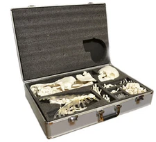 Disarticulated Human Skeleton, Full, Life-Sized (62" Height) with Premium Metal