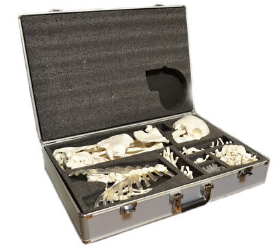 Disarticulated Human Skeleton, Full, Life-Sized (62'' Height) with Premium Metal
