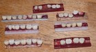 LOT OF 7 VINTAGE TRUBYTE BIOFORM DENTRON DIATORIC DENTAL TEETH SHADE GUIDE — photo 2
