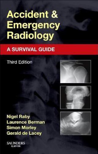 Accident and Emergency Radiology: a Survival Guide by Gerald de Lacey, Laurence