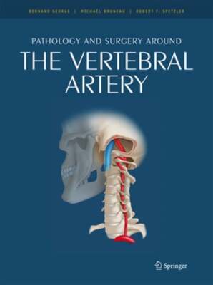 Pathology and Surgery Around the Vertebral Artery by Bernard George: New