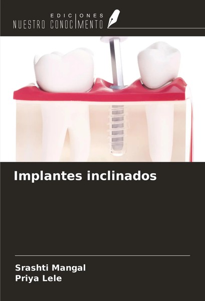 Implantes Inclinados Srashti Mangal (U. A.) Taschenbuch Spanisch 2024-image