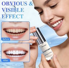 Tooth Whitening Paint Natural, Portable, Safe Formula for Bright Smile