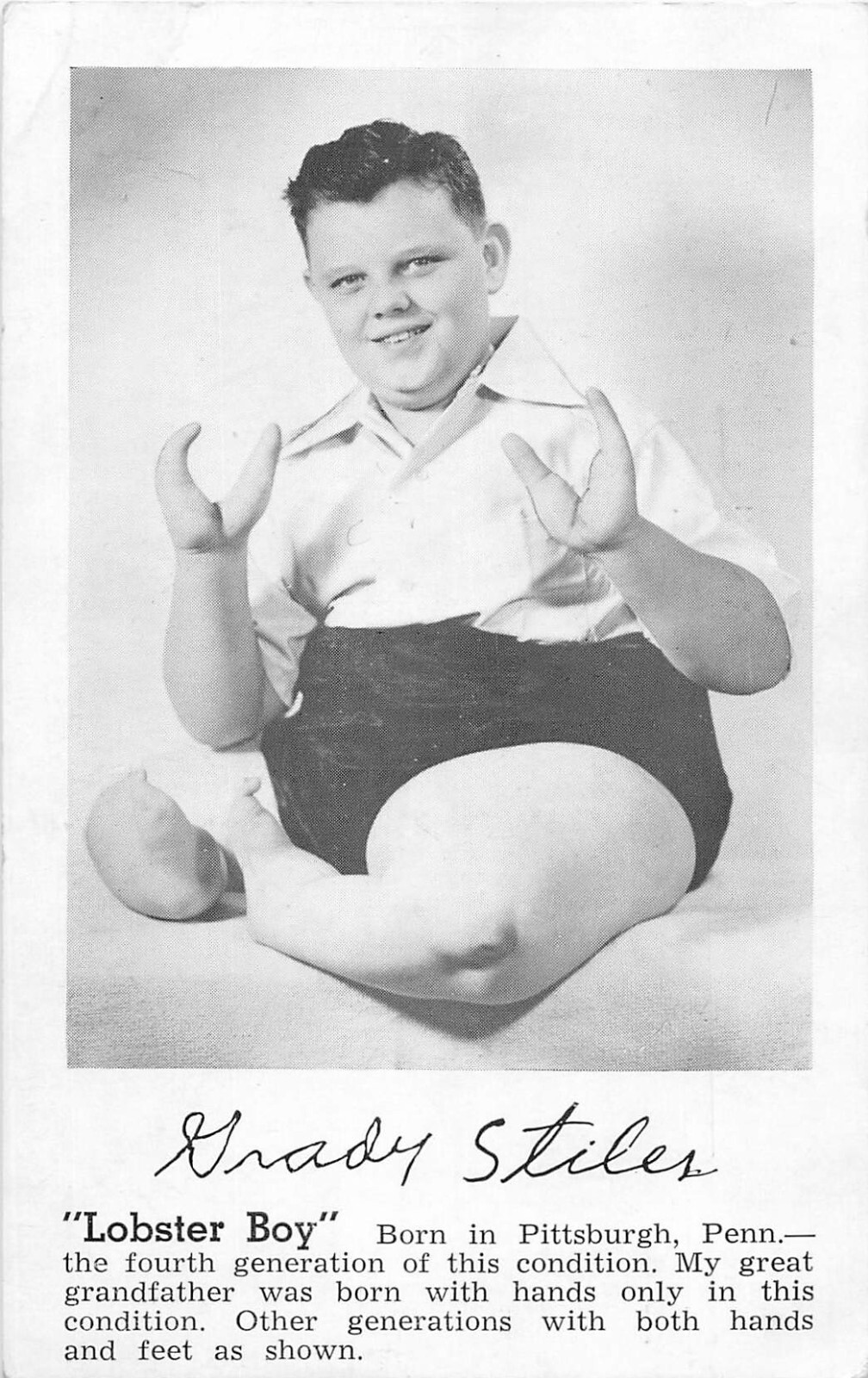 Grady Stiles "Lobster Boy" Circus Sideshow Freak Blank Back Postcard