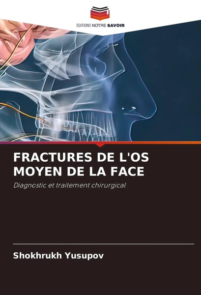 Shokhrukh Yusupov | Fractures DE L'os Moyen DE LA Face | Taschenbuch (2024)-image
