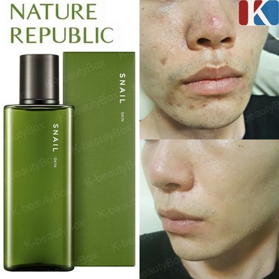 Nature Republic Snail Solution Homme Skin Toner 170ml Man S Skin Care Ebay