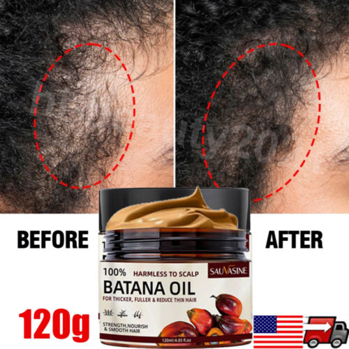 2~Batana Oil Conditioner for Hair Growth,Anti Hair Loss,Healthier Thicker Fuller - Picture 4 of 24
